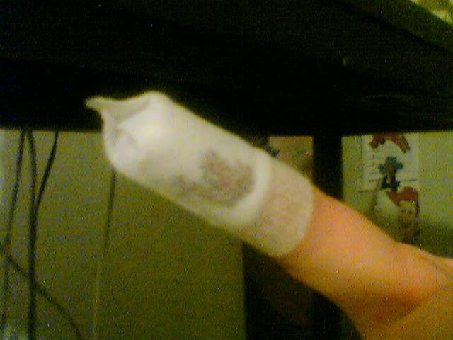 Injured Finger